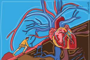 A Randolph Pherson le diagnosticaron el síndrome de VEXAS, que es causado por una mutación del gen UBA1 ubicado en el cromosoma X