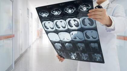 A través de un escáner los doctores pudieron hallar, por fin, la causa del dolor de estómago (Foto: iStock)