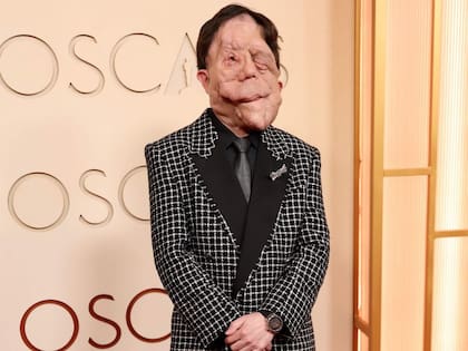 Adam Pearson asistió a la ceremonia de los Premios Oscar 2026