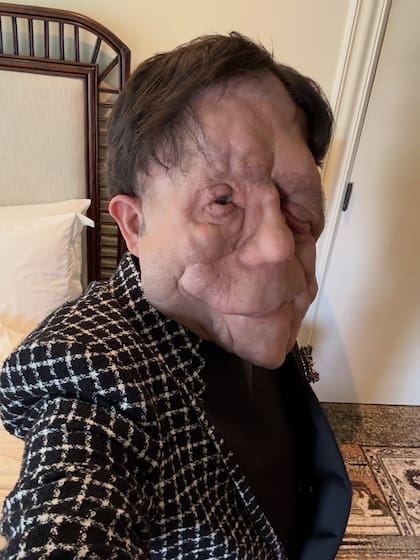 Adam Pearson compartió en sus redes sociales su emoción por asistir por primera vez a los Premios Oscar