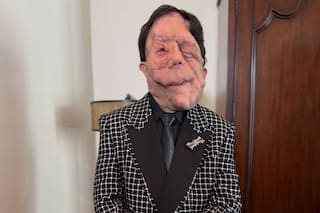 El actor con neurofibromatosis que asistió a los Oscar para visibilizar su enfermedad