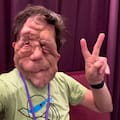 Qué es y cómo se trata la neurofibromatosis, la enfermedad que tiene el actor Adam Pearson