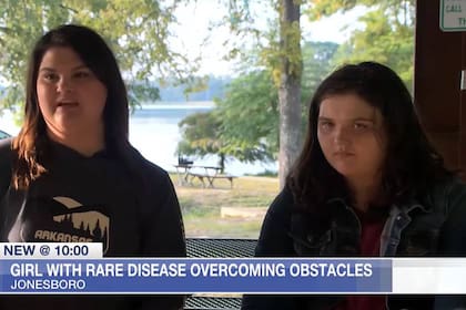 Addisyon junto a su mamá, Emily, que contó detalles sobre la vida de su hija con el síndrome Weaver-Smith