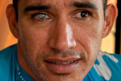 Además de perder los dos brazos y una pierna, Juan José quedó ciego de un ojo y sordo de un oído