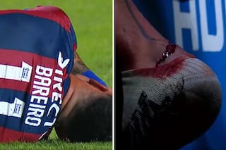 El crudo posteo de Adam Bareiro tras recibir un brutal pisotón que requirió puntos de sutura