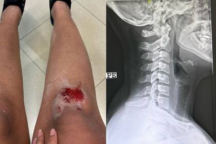 Adriana González compartió las lesiones que le causó la agresión