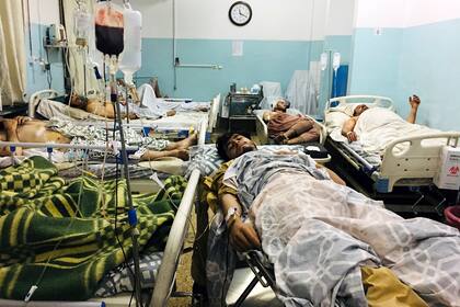 Afganos heridos yacen en una cama en un hospital después de una explosión mortal fuera del aeropuerto de Kabul, Afganistán.