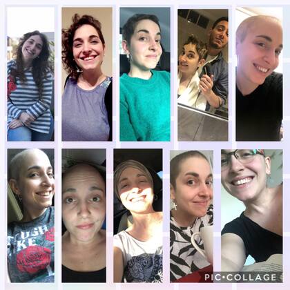 Agustina se operó el 28 agosto de 2018 y el 2 de octubre comenzó con el tratamiento que incluyó 16 sesiones de quimioterapia y más adelante otras 33 de rayos.