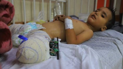 Ahmed Shabat, de 3 años, perdió sus piernas en una explosión en Gaza