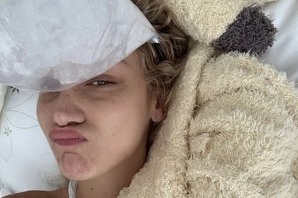 Al igual que su madre y hermanos, Bella Hadid padece de la enfermedad Lyme