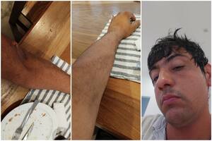 Al productor Luigi Lupi se le prendió fuego el tractor