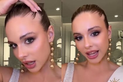 Aldana Masset, en su cuenta de TikTok, confirmó que tiene alopecia, una enfermedad autoinmunitaria que afecta al cuero cabelludo