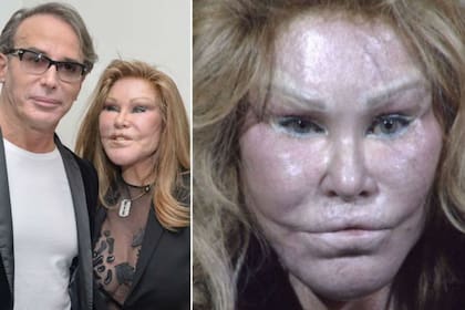 Alec Wildenstein y su exesposa Jocelyn