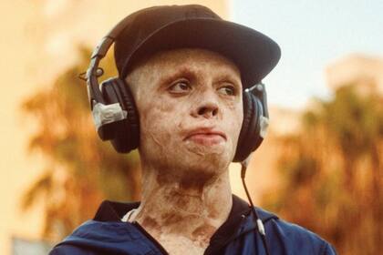 Aleixo Paz se descubre sin filtros en un testimonio sobre la crudeza que a veces tiene la vida