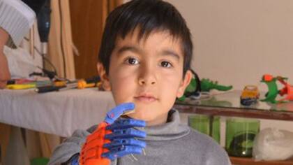 Alejabdro Calatayú muestra el brazo que le construyó su papá