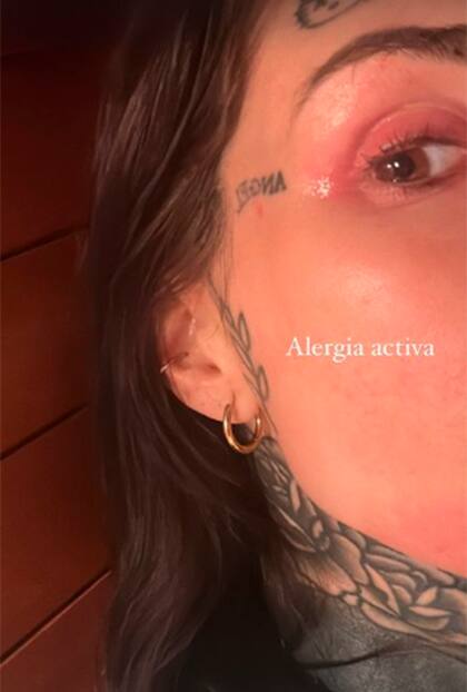 "Alergia activa", el diagnóstico que recibió Candelaria Tinelli
