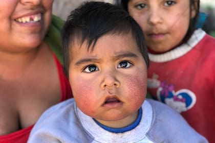 Alexander Castillo que tiene 1 año y media y los cachetes como quemados por el sol. Su mamá, Elina Castillo, explica que es de jugar todo el día sobre la tierra, en el paraje perdido de El Hoyo, en Santiago del Estero.