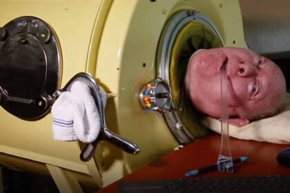 Alexander Paul vive desde los 6 años dentro de un pulmón de acero, lo cual no impidió que terminara la secundaria y se recibiera de abogado