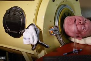 Murió Paul Alexander, el hombre que sobrevivió a la polio y vivió 70 años en un “pulmón de acero”