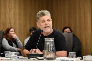 Alfredo Casero está internado con pronóstico reservado después de que se complicara una operación a la que debió someterse