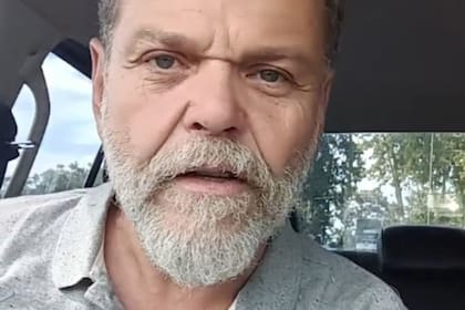 Alfredo Casero está internado con pronóstico reservado después de que se complicara una operación de cadera