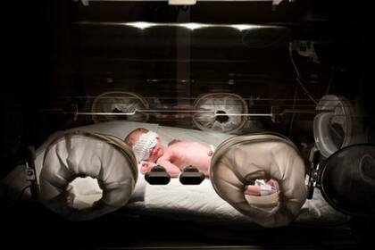 Algunos médicos consideran que la incubadora no es idónea para todos los niños