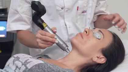 Alma Q permite borrar manchas y se puede aplicar en verano