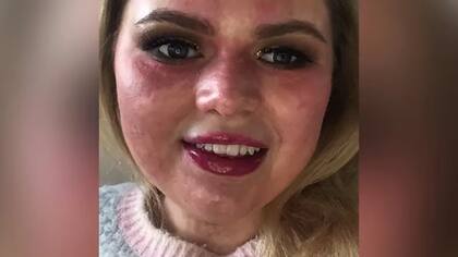 Amba Smith dice que ha aprendido a no permitir que su marca física defina quién es