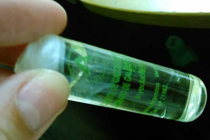 Ampollas. Fotografías a las que accedió la nacion muestran partículas y hongos en dosis de gluconato de calcio, un complejo de minerales muy utilizado en los hospitales, elaboradas por Surar Pharma