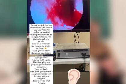 Anahí mostró la perforación de tímpano que sufrió mientras le probaban los monitores