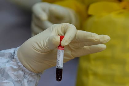 "Lograr una vacuna contra el coronavirus puede llevar años"