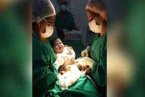 Una mujer dio a luz a un “bebé gigante” de 7,3 kilos