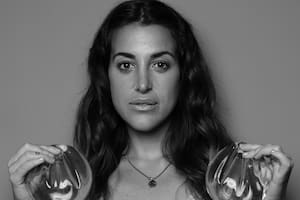 Angie Monasterio se sacó sus prótesis