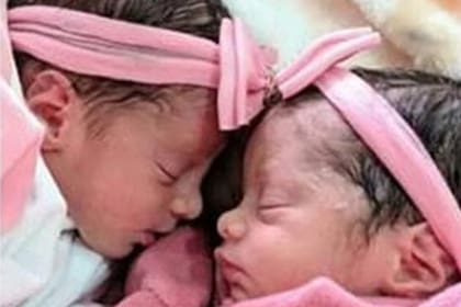 Anne y Analú tenían 26 días de vida hasta que fueron embestidas por el perro de la famila