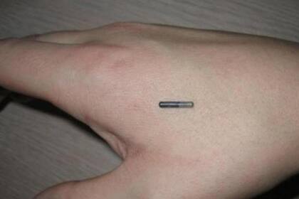 Antes de ser implantado, Amal Graafstra, una entusiasta del biohacking, muestra un chip RFID sobre su mano