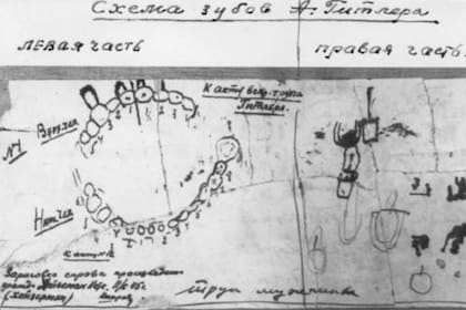 Antes de ver las piezas dentarias de Adolf Hitler, Käthe Heusermann dibujó pormenorizadamente la dentadura del dictador