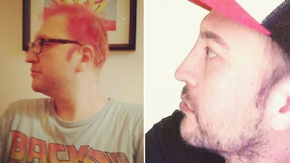 Antes y después: el rostro de Leo García