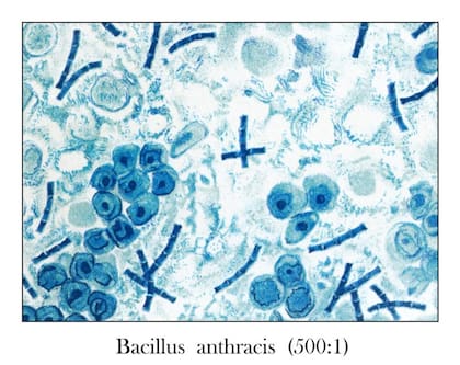 Antigua ilustración grabada de Bacillus anthracis en la sangre bajo el microscopio.