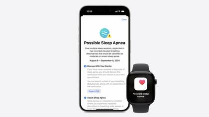 Apnea de sueño en el Apple Watch 10 y Watch 9