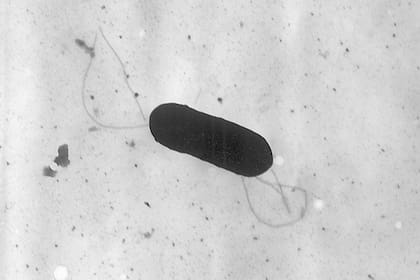 ARCHIVO - Esta imagen tomada con un microscopio electrónico y facilitada por los Centros para el Control y la Prevención de Enfermedades de Estados Unidos muestra una bacteria Listeria 