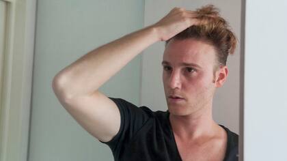 Ariel Luongo se hizo un trasplante capilar hace seis meses; ante los resultados, a muchos les dice que fue el cambio de champú