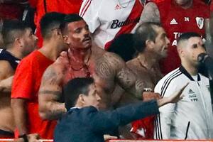 Ariel "Pato" Calvici, uno de los líderes de la barra brava de River, con el rostro cubierto de sangre tras la pelea con la policía peruana