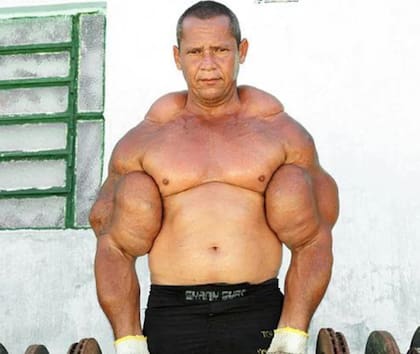 Arlindo falleció luego de sufrir una falla generalizada en su cuerpo (Foto: X)