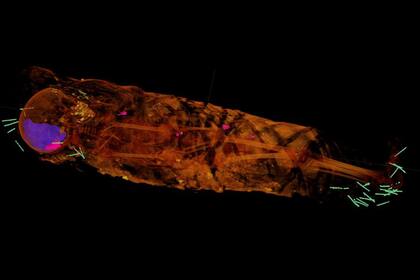 La difracción de rayos X mostró alambres o alfileres metálicos modernos que pudieron haberse añadido en el siglo pasado para estabilizar el envoltorio