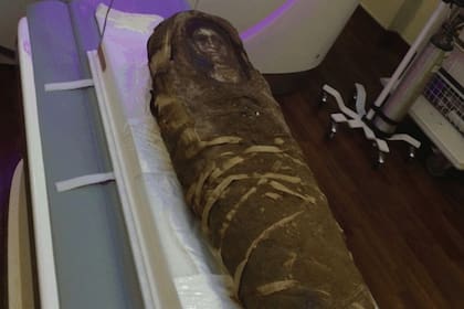 Los arqueólogos estudiaron con rayos X la momia y encontraron un misterioso objeto que se había colocado sobre el abdomen en el momento de la momificación