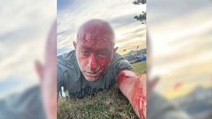 Arsen Ostrovsky en la escena del ataque a tiros Foto: Jersulamen Post