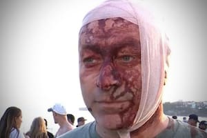 Una de las víctimas del atentado en Australia también sobrevivió al ataque de Hamas el 7 de octubre