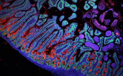 ¿Arte o ciencia? Esta imagen muestra cuántos genes se activan para desarrollar el intestino delgado