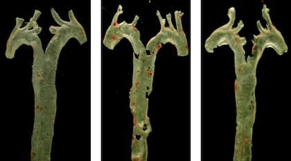 Arterias aortas de un ratón sano (izquierda), otro expuesto a propionato de imidazol (centro) y otro tratado con propionato y un fármaco inhibidor, con tinción en rojo de la placa aterosclerótica