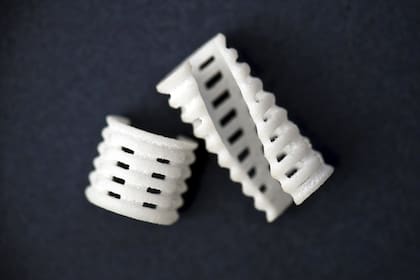 Así es el implante que se usó para ayudar a los chicos a respirar hasta que fueron suficientemente grandes